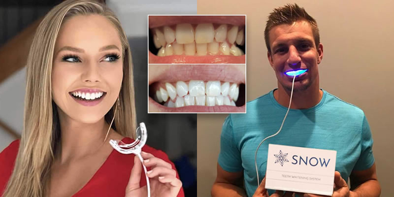 Snow Teeth Whitening